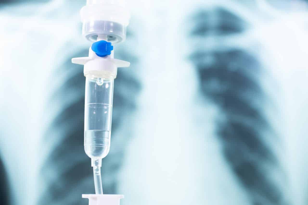 Medical drip and an x-ray of the lungs